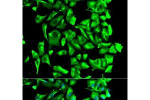 Immunofluorescence analysis of U2OS cells using HSP90AB1 Polyclonal Antibody (HSP90AB1 anticorps)