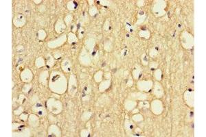 Immunohistochemistry of paraffin-embedded human brain tissue using ABIN7168091 at dilution of 1:100 (Riboflavin Kinase anticorps  (AA 1-154))