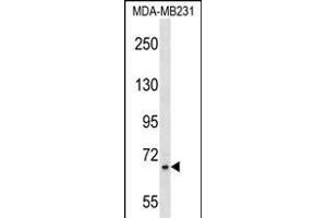 ZNF44 Antibody (N-term) (ABIN1539529 and ABIN2850156) western blot analysis in MDA-M cell line lysates (35 μg/lane). (Zinc Finger Protein 44 anticorps  (N-Term))