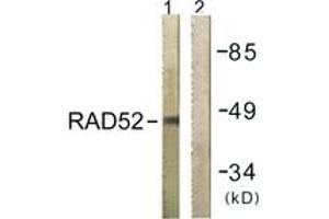 Western blot analysis of extracts from 293 cells, using RAD52 (Ab-104) Antibody.