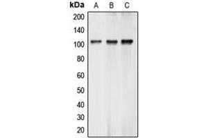 Western blot analysis of BCLAF1 expression in K562 (A), MCF7 (B), A549 (C) whole cell lysates. (BCLAF1 anticorps  (Center))
