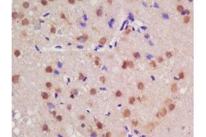 Formalin-fixed and paraffin embedded rat brain labeled with Rabbit Anti-Guanylyl Cyclase alpha 1 Polyclonal Antibody, Unconjugated  at 1:200 followed by conjugation to the secondary antibody and DAB staining (GUCY1A1 anticorps  (AA 301-400))