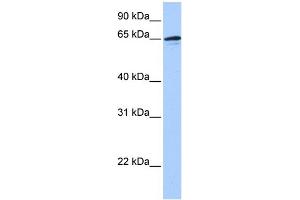 WB Suggested Anti-ZNF417 Antibody Titration:  0. (ZNF417 anticorps  (N-Term))