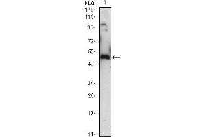 Western blot analysis using EGR1 mouse mAb against EGR1-hIgGFc transfected HEK293 (1)cell lysate. (EGR1 anticorps)