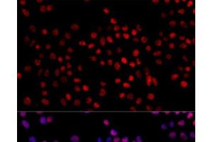 Immunofluorescence analysis of 293T cells using XRCC4 Polyclonal Antibody at dilution of 1:100. (XRCC4 anticorps)