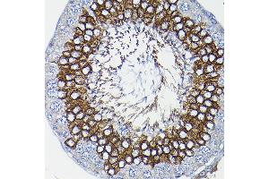Immunohistochemistry of paraffin-embedded rat testis using ICMT Rabbit pAb (ABIN6128077, ABIN6142129, ABIN6142130 and ABIN6214491) at dilution of 1:200 (40x lens).