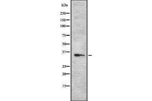Western blot analysis Sarcoglycan-β using Jurkat whole cell lysates (SGCB anticorps  (N-Term))