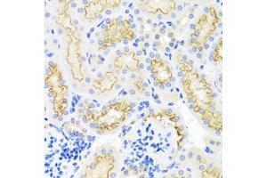 Immunohistochemistry of paraffin-embedded mouse kidney using SRPX antibody (ABIN5970559) at dilution of 1/100 (40x lens). (SRPX anticorps)