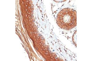 Immunohistochemistry of paraffin-embedded rat skin using PERP Rabbit mAb (ABIN7270861) at dilution of 1:100 (40x lens). (PERP anticorps)