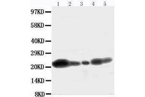 Anti-Caveolin-1 antibody, Western blotting Lane 1: U87 Cell Lysate Lane 2: HELA Cell Lysate Lane 3: MCF-7 Cell Lysate Lane 4: A549 Cell Lysate Lane 5:  Cell Lysate