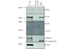 Immunoprecipitation analysis using Mouse Anti-VPS35 Monoclonal Antibody, Clone 5A9 (ABIN6932951). (VPS35 anticorps  (HRP))