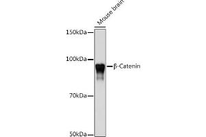 Western blot analysis of extracts of Mouse brain, using β-Catenin antibody (ABIN7266138) at 1:1000 dilution.