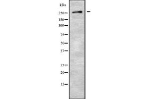 Western blot analysis GPR179 using 293 whole cell lysates (GPR179 anticorps  (C-Term))