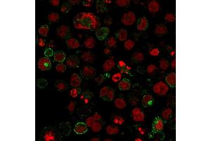 Immunofluorescence staining of K562 cells using GLUT-1 Mouse Monoclonal Antibody (GLUT1/2475) followed by goat anti-Mouse IgG conjugated to CF488 (green).