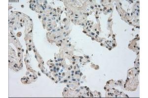 Image no. 8 for anti-Neurotrophic tyrosine Kinase, Receptor, Type 3 (NTRK3) antibody (ABIN1499842)