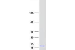 Validation with Western Blot