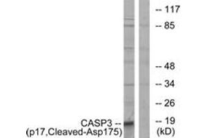 Western blot analysis of extracts from COLO cells, using Caspase 3 (p17,Cleaved-Asp175) Antibody. (Caspase 3 anticorps  (Cleaved-Asp175))