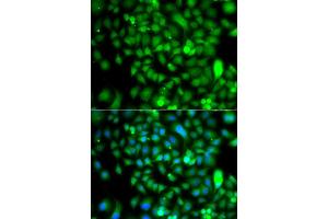 Immunofluorescence analysis of A549 cell using CSRP2BP antibody. (CSRP2BP anticorps)