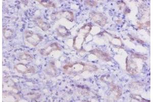 Immunohistochemistry of paraffin-embedded human kidney tissue using ABIN7178829 at dilution of 1:20 (Cathepsin K anticorps  (AA 115-329))