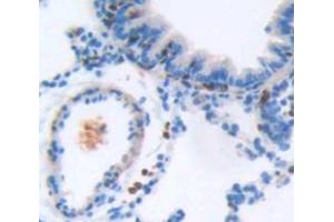 IHC-P analysis of Rat Tissue, with DAB staining. (ICAM4 anticorps  (AA 32-226))