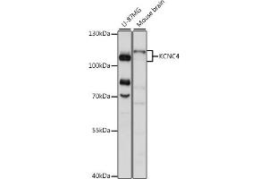 Western blot analysis of extracts of various cell lines, using KCNC4 antibody (ABIN7269488) at 1:1000 dilution. (Kv3.4 anticorps  (AA 490-538))