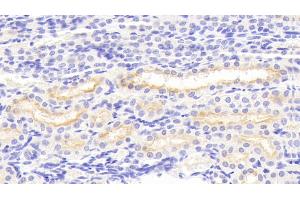 Detection of MMP3 in Porcine Kidney Tissue using Polyclonal Antibody to Matrix Metalloproteinase 3 (MMP3)