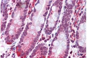 Human Small Intestine: Formalin-Fixed, Paraffin-Embedded (FFPE) (SCARA5 anticorps  (C-Term))
