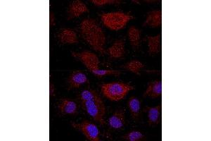 Confocal immunofluorescence analysis of HeLa cells using RPL21 antibody (ABIN7269996) at dilution of 1:200.