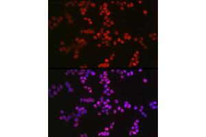Immunofluorescence analysis of F9 cells using TET2 Rabbit pAb (ABIN7270780) at dilution of 1:100 (40x lens).