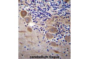 Immunohistochemistry (IHC) image for anti-Signal Sequence Receptor, beta (Translocon-Associated Protein Beta) (SSR2) antibody (ABIN2997190) (SSR2 anticorps)