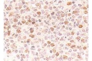 Immunohistochemistry (IHC) image for anti-Cell Division Cycle 7 (CDC7) antibody (ABIN487481) (CDC7 anticorps)