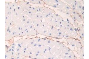 Detection of FBN1 in Mouse Heart Tissue using Polyclonal Antibody to Fibrillin 1 (FBN1)