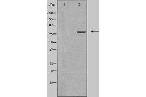 Western blot analysis of extracts from COLO cells, using TRIM3 antibody. (TRIM3 anticorps  (Internal Region))