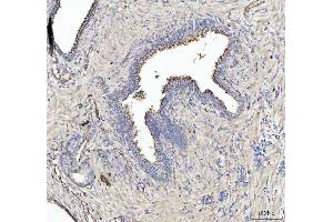 IHC analysis of ZAP70 using anti-ZAP70 antibody (ABIN4886773).