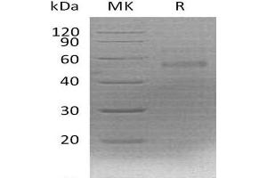 Western Blotting (WB) image for Coagulation Factor X (F10) protein (His tag) (ABIN7320491)