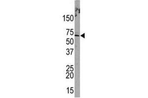 Western blot analysis of PML antibody and HeLa lysate. (PML anticorps  (Sumoylation Site))
