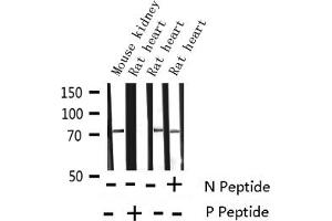 Western blot analysis of Phospho-Tau (Thr231) expression in various lysates