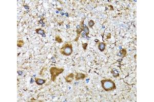 Immunohistochemistry of paraffin-embedded Mouse spinal cord using MAP1LC3A Polyclonal Antibody at dilution of 1:100 (40x lens). (MAP1LC3A anticorps)