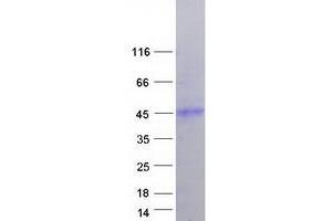 Validation with Western Blot