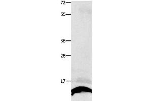 Western Blot analysis of Human liver cancer tissue using COX5B Polyclonal Antibody at dilution of 1:250 (COX5B anticorps)