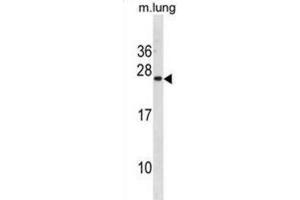 Western Blotting (WB) image for anti-Iron-sulfur cluster assembly enzyme ISCU, mitochondrial (ISCU) antibody (ABIN3001333) (ISCU anticorps)