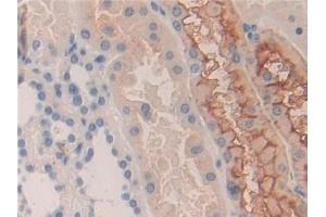 DAB staining on IHC-P; Samples: Human Kidney Tissue (KIR2DS2 anticorps  (AA 22-304))