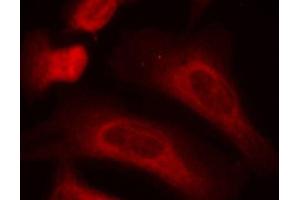 Immunofluorescence staining of methanol-fixed HeLa cells using Phospho-STAT1-S727 antibody (ABIN2988310). (STAT1 anticorps  (pSer727))