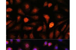 Immunofluorescence analysis of L-929 cells using CDK5RAP1 Polyclonal Antibody at dilution of 1:100.