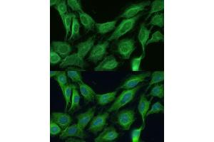 Immunofluorescence analysis of C6 cells using CNNM1 antibody (ABIN7266572) at dilution of 1:100.