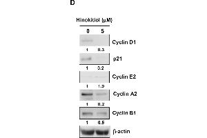 The effect of hinokitiol on cell cycle distribution.