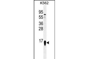RPS19 Antibody (Center) (ABIN655978 and ABIN2845362) western blot analysis in K562 cell line lysates (35 μg/lane). (RPS19 anticorps  (AA 25-54))