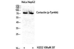 Western Blot (WB) analysis of specific cells using Phospho-Cortactin (Y466) Polyclonal Antibody. (Cortactin anticorps  (pTyr466))