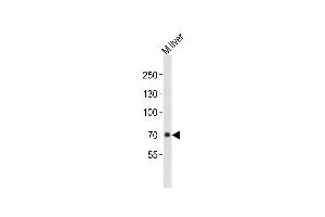 Anti-ALB Antibody (C-term)at 1:1000 dilution + mouse liver lysates Lysates/proteins at 20 μg per lane. (Albumin anticorps  (C-Term))