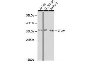 Western blot analysis of extracts of various cell lines using STOM Polyclonal Antibody at dilution of 1:1000. (Stomatin anticorps)